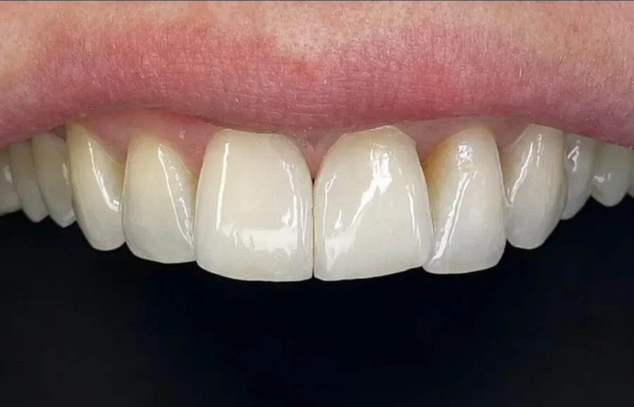Therapeutic dentistry — After