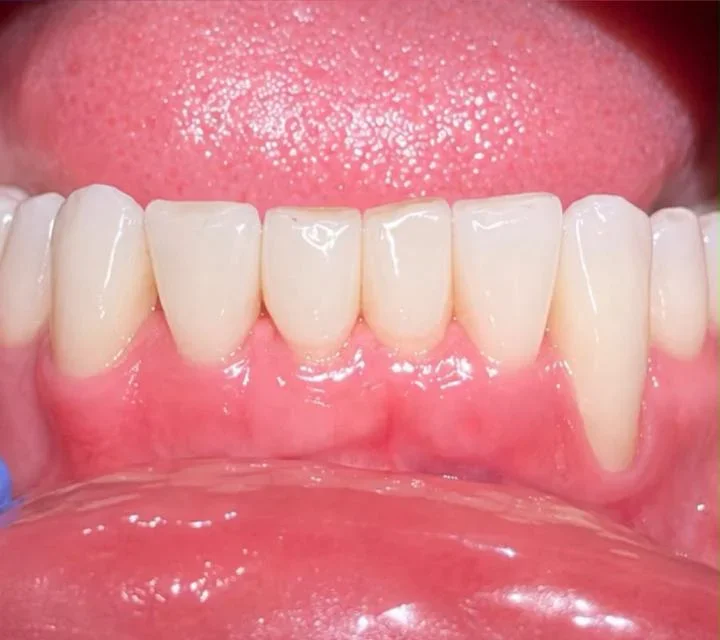 Therapeutic dentistry — After
