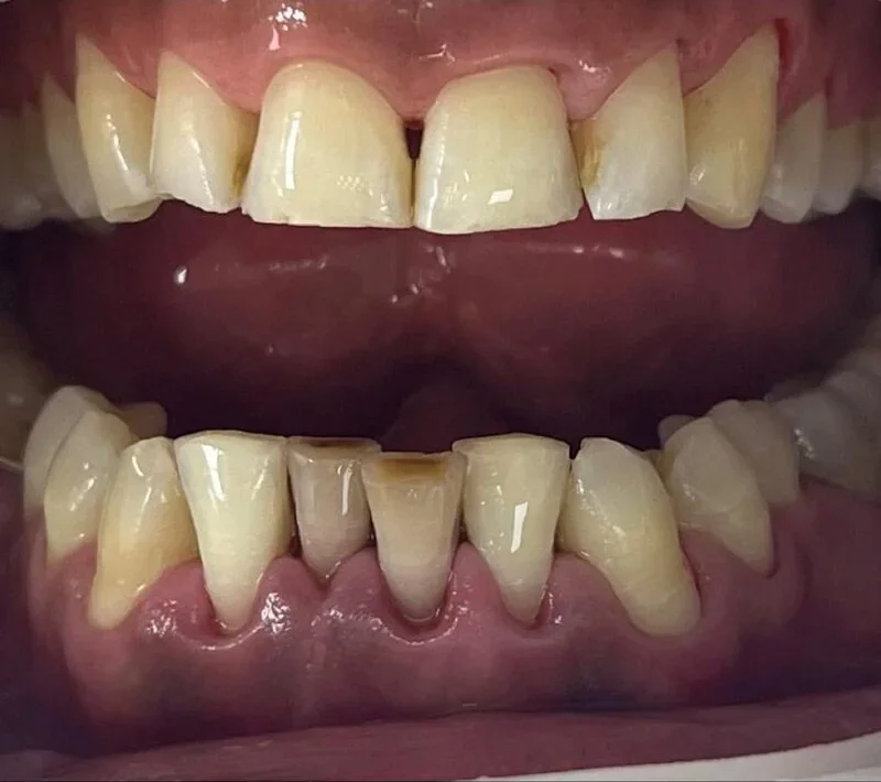 Periodontology — After