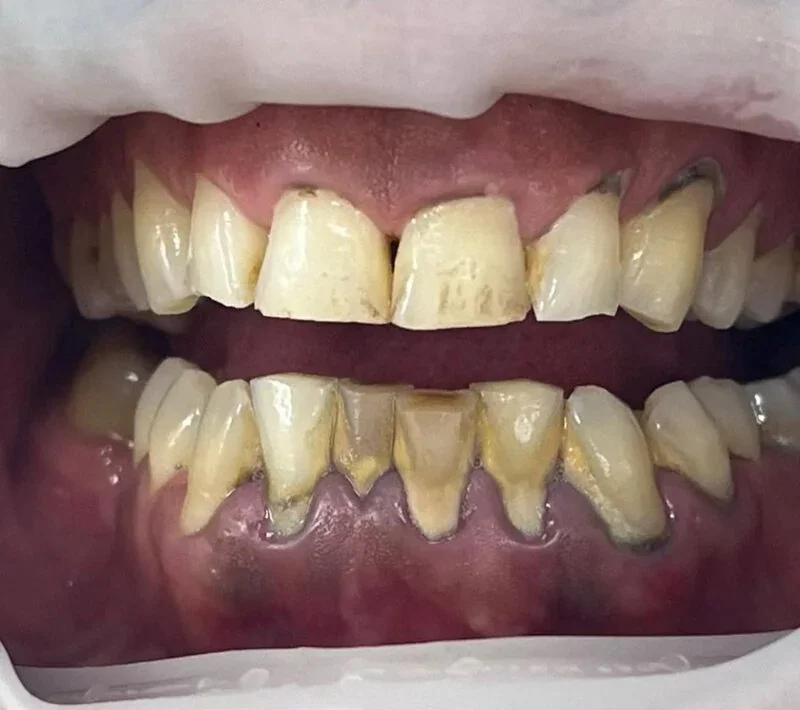 Periodontology — Before