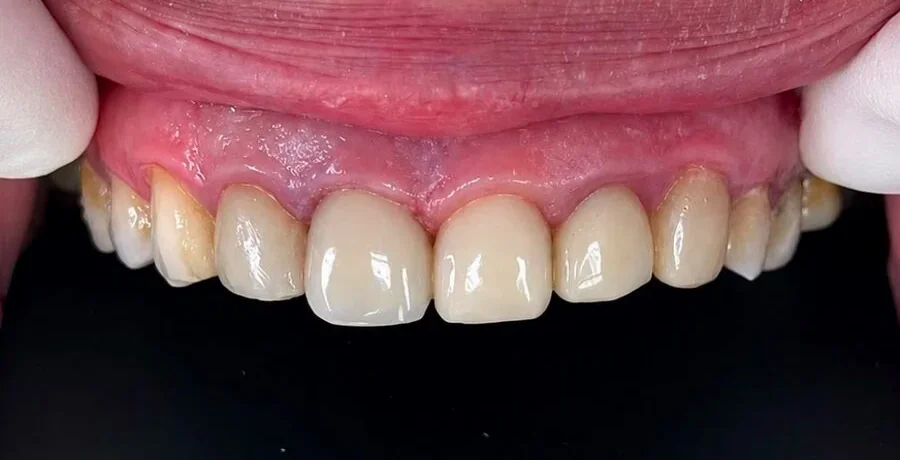 Therapeutic dentistry — After